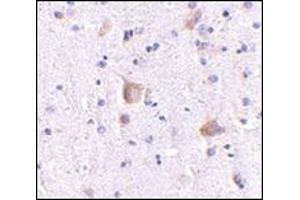 anti-Regulating Synaptic Membrane Exocytosis 2 (RIMS2) (Center) antibody