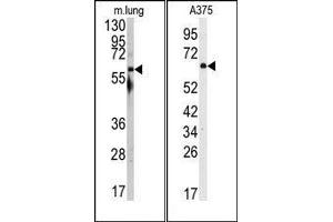 Image no. 1 for anti-Nuclear Receptor Coactivator 1 (NCOA1) (N-Term) antibody (ABIN359992) (NCOA1 anticorps  (N-Term))