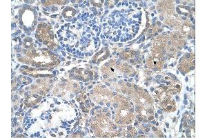 Immunohistochemistry (IHC) image for anti-Sarcosine Dehydrogenase (SARDH) (Middle Region) antibody (ABIN2775361)