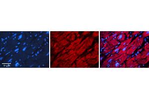 Rabbit Anti-DHODH Antibody Catalog Number: ARP41939_P050 Formalin Fixed Paraffin Embedded Tissue: Human heart Tissue Observed Staining: Cytoplasmic Primary Antibody Concentration: 1:100 Other Working Concentrations: N/A Secondary Antibody: Donkey anti-Rabbit-Cy3 Secondary Antibody Concentration: 1:200 Magnification: 20X Exposure Time: 0.
