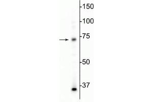 Western blot of mouse whole brain lysate showing specific immunolabeling of the MeCP2 protein at ~75 kDa. (MECP2 anticorps)
