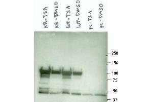 Image no. 1 for anti-Heat Shock Protein 90kDa alpha (Cytosolic), Class A Member 1 (HSP90AA1) (AA 289-300) antibody (ABIN401342) (HSP90AA1 anticorps  (AA 289-300))