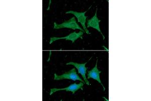 ICC/IF analysis of Calmodulin in HeLa cells. (Calmodulin 2 anticorps  (AA 1-149))