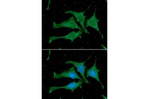 ICC/IF analysis of Calmodulin in HeLa cells. (Calmodulin 1 anticorps)