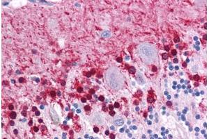 Human Brain, Cerebellum: Formalin-Fixed, Paraffin-Embedded (FFPE)