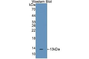 Western blot analysis of the recombinant protein. (IL17F anticorps  (AA 31-163))