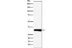 Western blot analysis of Bcl10 expression in HeLa cell lysate.