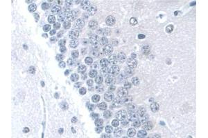 Detection of KIBRA in Mouse Cerebrum Tissue using Polyclonal Antibody to Kidney And Brain Protein (KIBRA)
