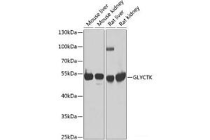 Western blot analysis of extracts of various cell lines using GLYCTK Polyclonal Antibody at dilution of 1:1000. (GLYCTK anticorps)