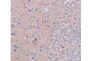 IHC-P analysis of Rat Tissue, with DAB staining. (CKM anticorps  (AA 11-367))