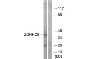 Western blot analysis of extracts from COLO cells, using ZDHHC9 Antibody.