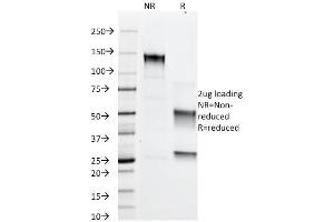 SDS-PAGE Analysis Purified Adipophilin Mouse Monoclonal Antibody (ADFP/1366). (ADRP anticorps  (AA 249-376))