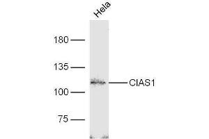 HeLa lysates probed with Rabbit Anti-Cryopyrin Polyclonal Antibody, Unconjugated  at 1:5000 for 90 min at 37˚C.