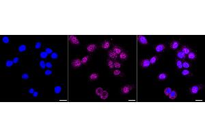 Immunocytochemical staining of HT- cells with CDT2 antibody (ABIN7798307), 1:1,000).