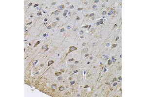Immunohistochemistry of paraffin-embedded rat brain using DRD3 Antibody (ABIN5970738) at dilution of 1/100 (40x lens).