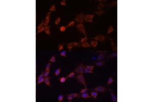 Immunofluorescence analysis of NIH-3T3 cells using PSMD14 Polyclonal Antibody (ABIN6131927, ABIN6146340, ABIN6146341 and ABIN6214977) at dilution of 1:100 (40x lens).