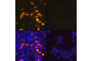 Immunofluorescence analysis of SARS-CoV-2 Nucleoprotein transfect Hela cells using SARS-CoV-2 Nucleoprotein pAb(ABIN7269053). (SARS-CoV-2 Envelope anticorps)