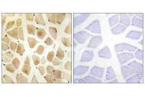 Immunohistochemistry analysis of paraffin-embedded human skeletal muscle tissue using SLK antibody. (SLK anticorps  (C-Term))