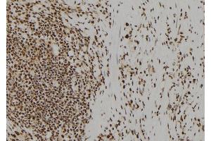 ABIN6277616 at 1/100 staining Human gastric tissue by IHC-P.