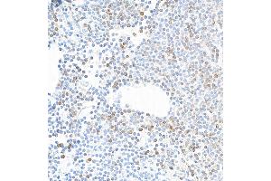 anti-Interleukin 7 Receptor (IL7R) (AA 21-236) antibody