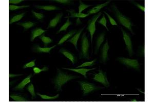 Immunofluorescence of monoclonal antibody to SSH1 on HeLa cell.
