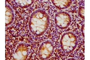 IHC image of ABIN7157950 diluted at 1:500 and staining in paraffin-embedded human appendix tissue performed on a Leica BondTM system.