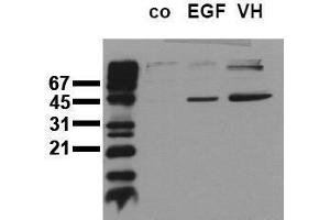 Western Blotting (WB) image for anti-Mitogen-Activated Protein Kinase Kinase 1 (MAP2K1) (pSer218), (pSer222), (pSer226) antibody (ABIN126836) (MEK1 anticorps  (pSer218, pSer222, pSer226))