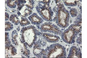 Image no. 2 for anti-RAB30, Member RAS Oncogene Family (RAB30) antibody (ABIN1500557)