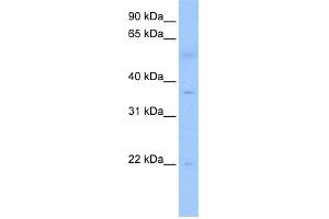 WB Suggested Anti-RG9MTD3 Antibody Titration:  0.