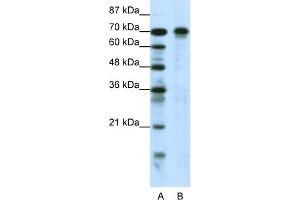 WB Suggested Anti-HIC1 Antibody Titration:  0. (HIC1 anticorps  (N-Term))