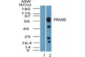 Image no. 1 for anti-Preferentially Expressed Antigen in Melanoma (PRAME) (AA 460-510) antibody (ABIN232167) (PRAME anticorps  (AA 460-510))