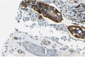 ABIN6274247 at 1/100 staining Mouse intestine tissue by IHC-P. (ACVRL1 anticorps  (Internal Region))