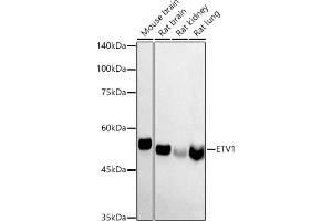 Western blot analysis of extracts of various cell lines, using ETV1 antibody (ABIN6129795, ABIN6140328, ABIN6140330 and ABIN6223003) at 1:1000 dilution. (ETV1 anticorps  (AA 1-200))