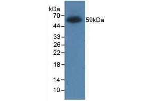 Detection of Recombinant Protein RPK170Hu01 with GST-tag using Anti-Glutathione S Transferase (GST) Tag Monoclonal Antibody (GST anticorps  (AA 1-218))