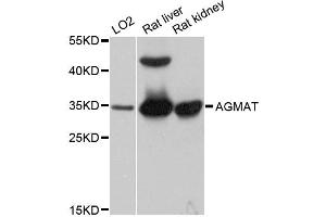 Western blot analysis of extracts of various cell lines, using AGMAT antibody. (AGMAT anticorps)
