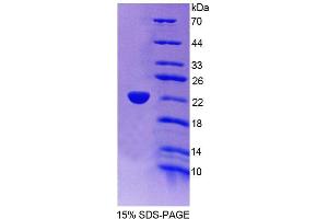 SDS-PAGE analysis of Mouse ACOX3 Protein.