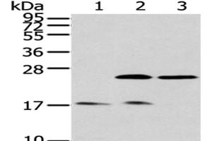 Western Blot analysis of Human fetal brain tissue, Hela and 293T cells using PDPN Polyclonal Antibody at dilution of 1/200 (Podoplanin anticorps)