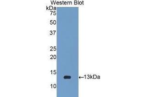 Western Blotting (WB) image for anti-beta-2-Microglobulin (B2M) (AA 22-119) antibody (ABIN1077854)