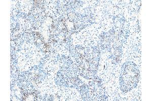 anti-CD28 (CD28) (AA 19-140) antibody