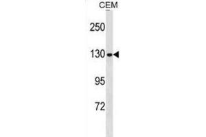Western Blotting (WB) image for anti-Non-SMC Condensin I Complex, Subunit G (NCAPG) antibody (ABIN3000708) (NCAPG anticorps)