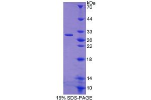 SDS-PAGE analysis of Rat CRISP1 Protein. (CRISP1 Protéine)
