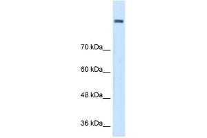 WB Suggested Anti-AOC2 Antibody Titration:  0. (AOC2 anticorps  (Middle Region))