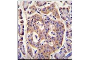 Immunohistochemistry analysis in formalin fixed and paraffin embedded human pancreas tissue reacted with PLD5 Antibody (C-term) followed which was  peroxidase conjugated to the secondary antibody and followed by DAB staining. (PLD5 anticorps  (C-Term))