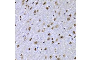 Immunohistochemistry of paraffin-embedded mouse brain using SOX5 antibody (ABIN2560088) at dilution of 1:100 (40x lens). (SOX5 anticorps)