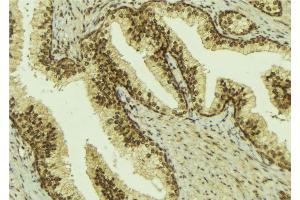 ABIN6274592 at 1/100 staining Mouse colon tissue by IHC-P. (BCOR anticorps  (Internal Region))