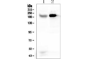 Western blot analysis of RRBP1 using anti-RRBP1 antibody (ABIN6719628).