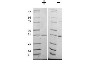 SDS-PAGE of Human Galectin-3 Recombinant Protein SDS-PAGE of Human Galectin-3 Recombinant Protein.
