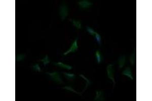Image no. 3 for anti-Carbonic Anhydrase 12 (CA12) antibody (ABIN1497065) (CA12 anticorps)