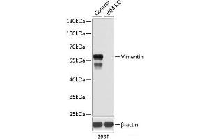 Western blot analysis of extracts from normal (control) and Vimentin knockout (KO) 293T cells using Vimentin Polyclonal Antibody at dilution of 1:1000. (Vimentin anticorps)