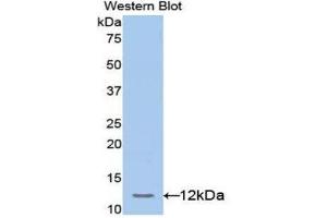 Western Blotting (WB) image for anti-Transcription Factor 20 (TCF20) (AA 125-213) antibody (ABIN1172584) (TCF20 anticorps  (AA 125-213))